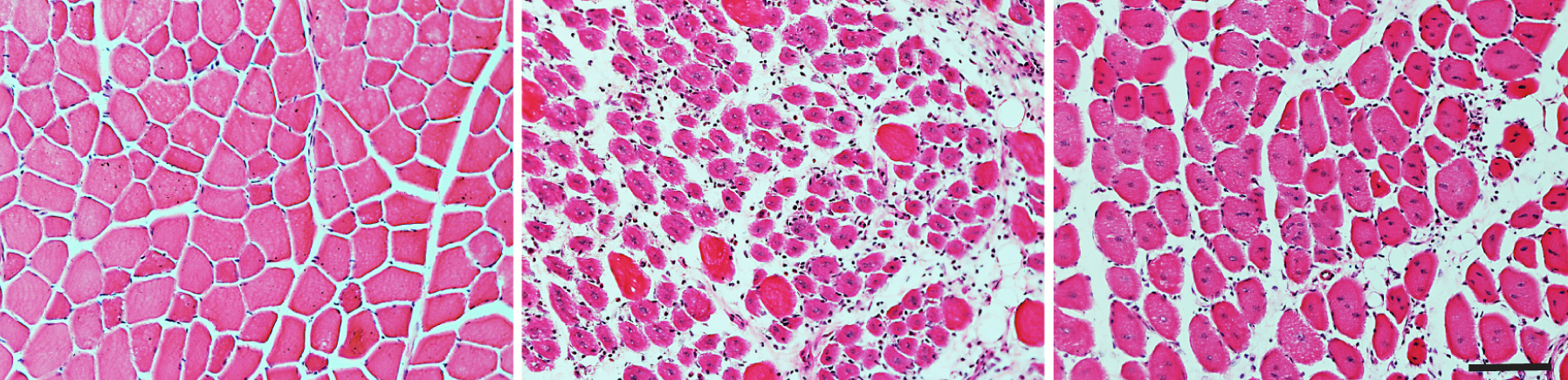 Musculoskeletal FIHC